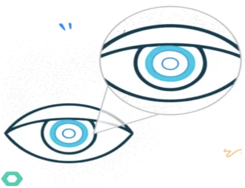 Cataract illustration