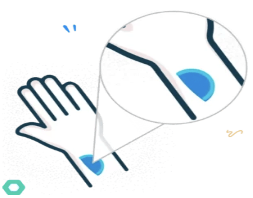 Cataract illustration