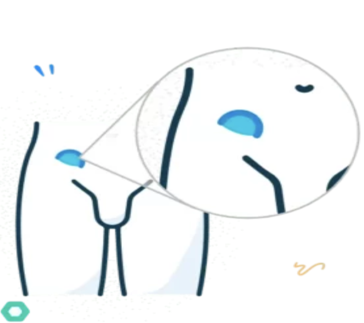 Cataract illustration