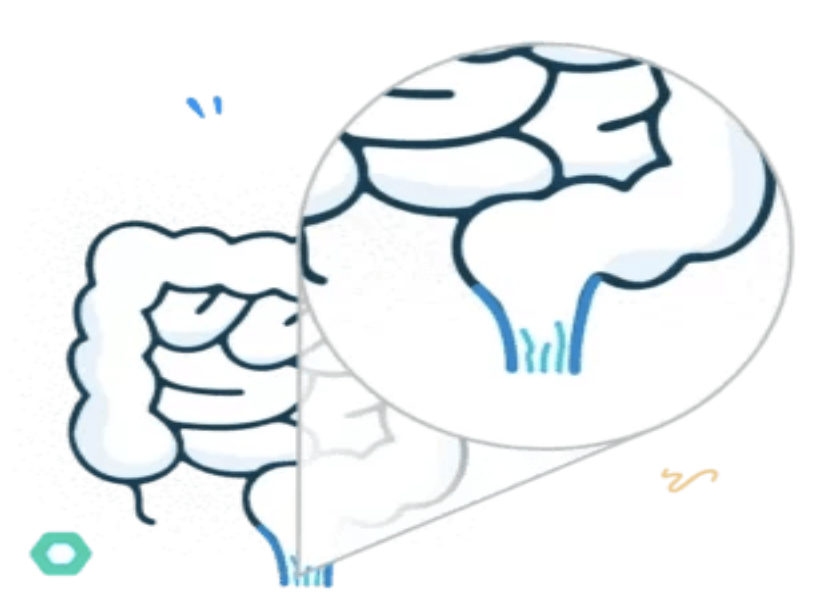 Cataract illustration