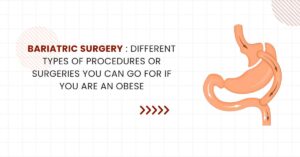 Read more about the article Bariatric Surgery : Different types of procedures or surgeries you can go for if you are an obese