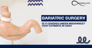 Read more about the article Decoding Bariatric Surgery: Insurance Coverage and Cost Estimates