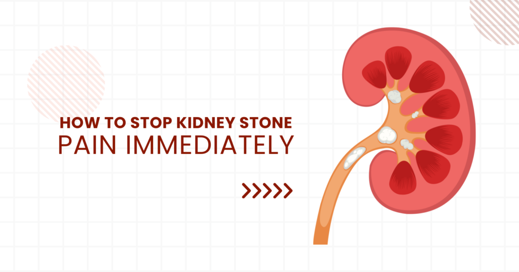 How to stop kidney stone pain immediately