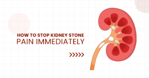 Read more about the article How to stop kidney stone pain immediately