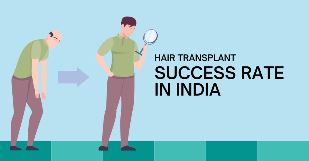 Hair Transplant Success Rate in India - Does It Work?