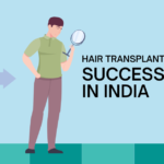 Hair Transplant Success Rate in India – Does It Work?