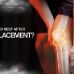 HOW LONG IS BED REST AFTER KNEE REPLACEMENT?