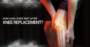 Read more about the article HOW LONG IS BED REST AFTER KNEE REPLACEMENT?