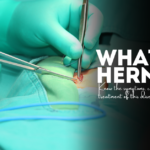 What is hernia? – Know the symptoms, causes and treatment of this disease