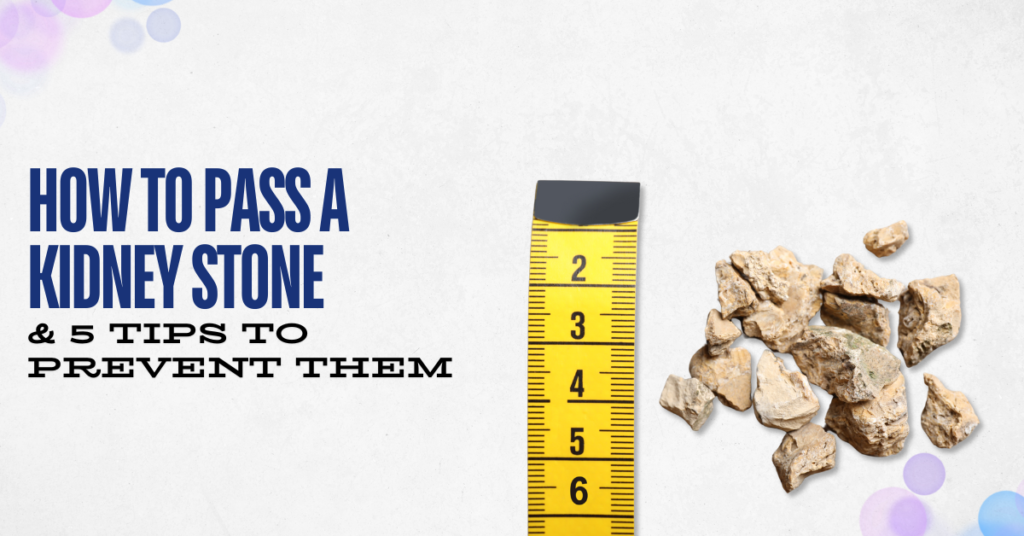 How to pass a kidney stone & 5 tips to prevent them