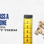 How to Pass a Kidney Stone & 5 Tips to Prevent Them