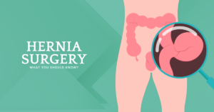 Read more about the article Hernia Surgery: What You Should Know