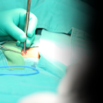 Understanding Hernia Surgery: Types, Cost and Risk