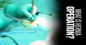 Read more about the article Understanding Hernia Surgery: Types, Cost and Risk