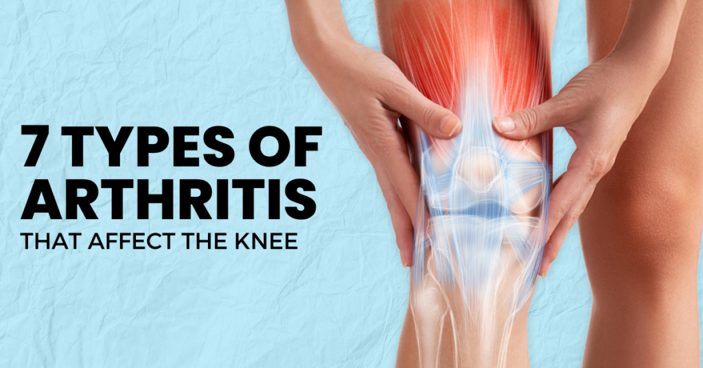 Understanding the 7 Types of Arthritis That Affect the Knee