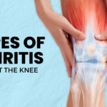 Understanding the 7 Types of Arthritis That Affect the Knee