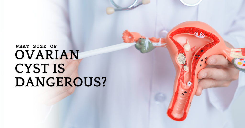 What Size of Ovarian Cyst is Dangerous?