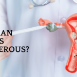 What Size of Ovarian Cyst is Dangerous?