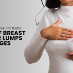 Breast Cancer Pictures – Types of Breast Cancer Lumps Images