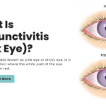 What Is Conjunctivitis (Pink Eye)?