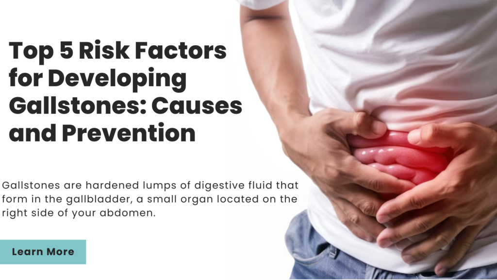 Top 5 Risk Factors for Developing Gallstones