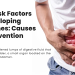 5 Major Risk Factors for Gallbladder Stones and Effective Treatment Options