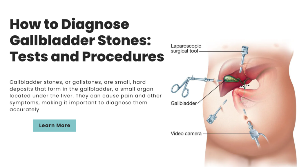 How to Diagnose Gallbladder Stones: Tests and Procedures