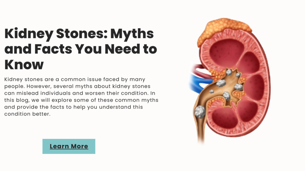 Kidney Stones: Myths and Facts You Need to Know