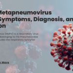 Human Metapneumovirus (HMPV): Symptoms, Diagnosis, and Prevention