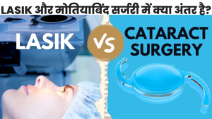 Read more about the article LASIK और मोतियाबिंद सर्जरी में क्या अंतर है?