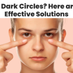 Having Dark Circles? Here are Some Effective Solutions