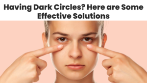 Read more about the article Having Dark Circles? Here are Some Effective Solutions